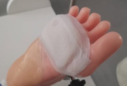 Odciążenie pozabiegowe – ważny element nauki na kierunku Podolog!